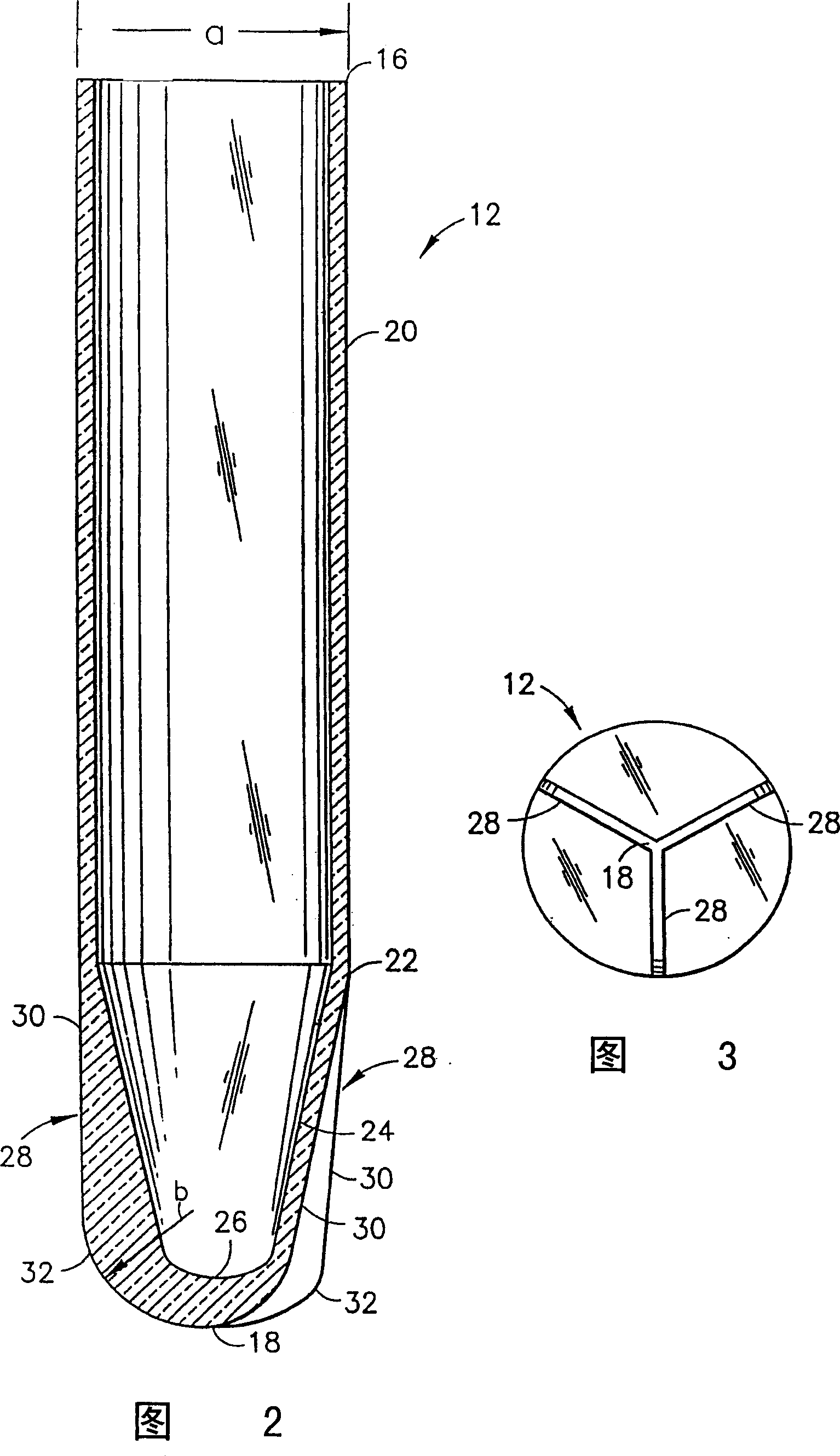 Vacuum tube and microscope inspection, chemical treatment and microbe determination method of urine precipitate