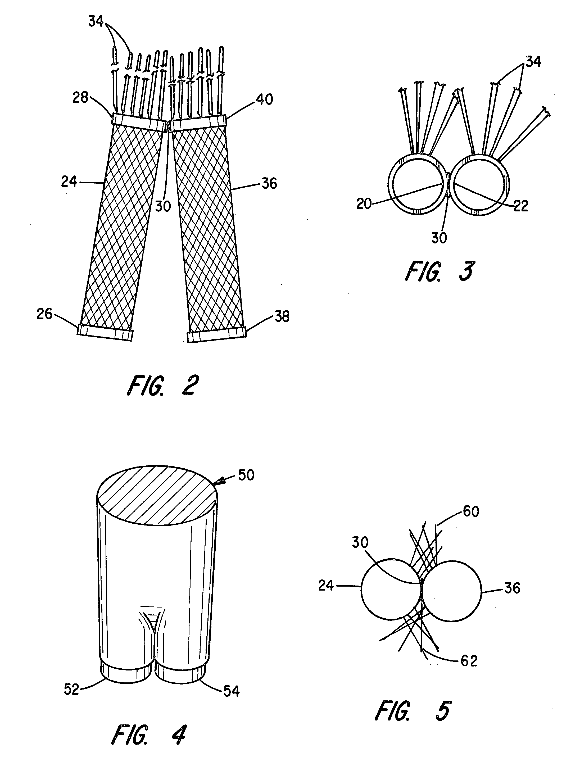 Branched stent/graft and method of fabrication