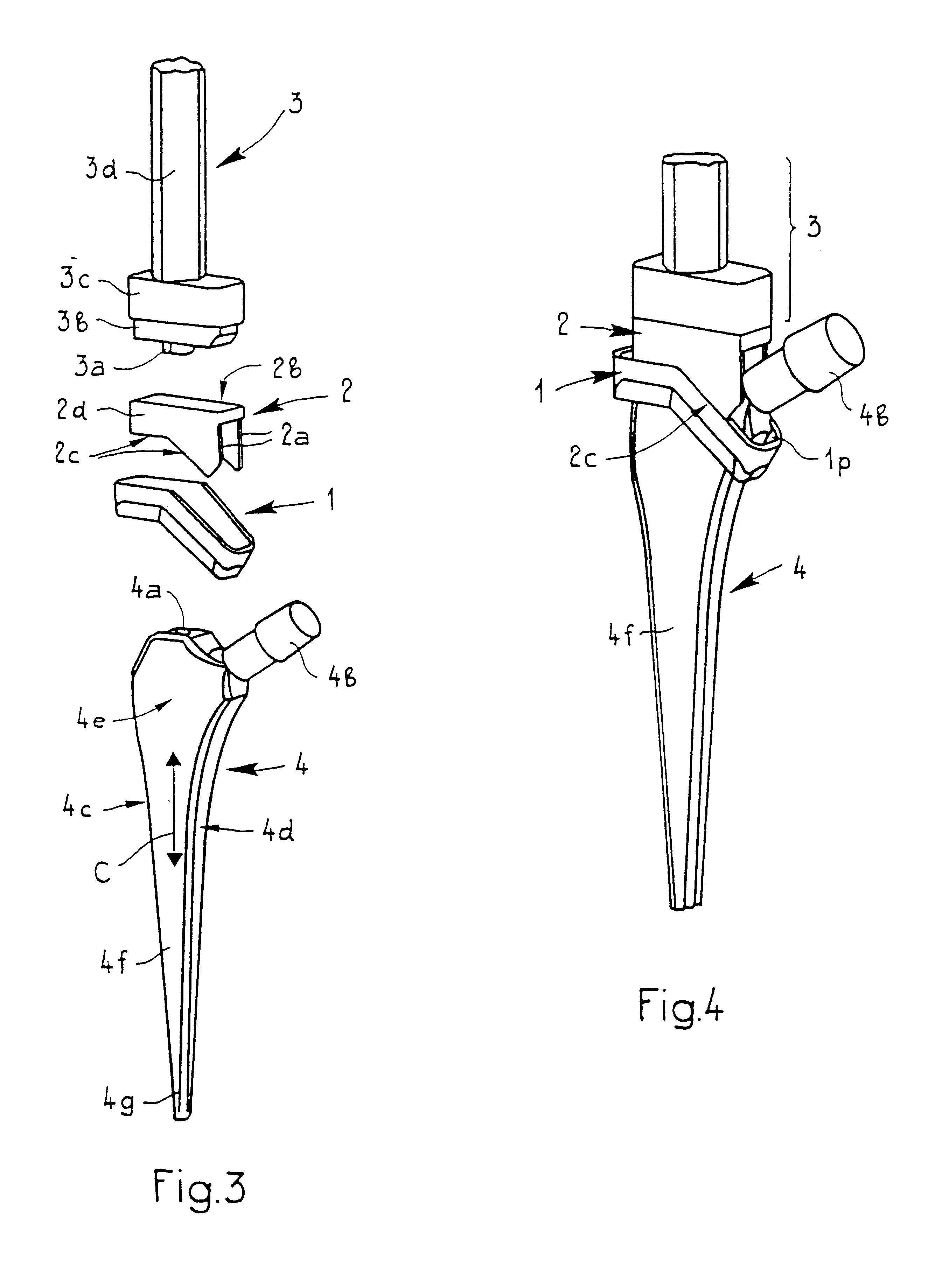 Kit for implanting a cementable endoprosthesis