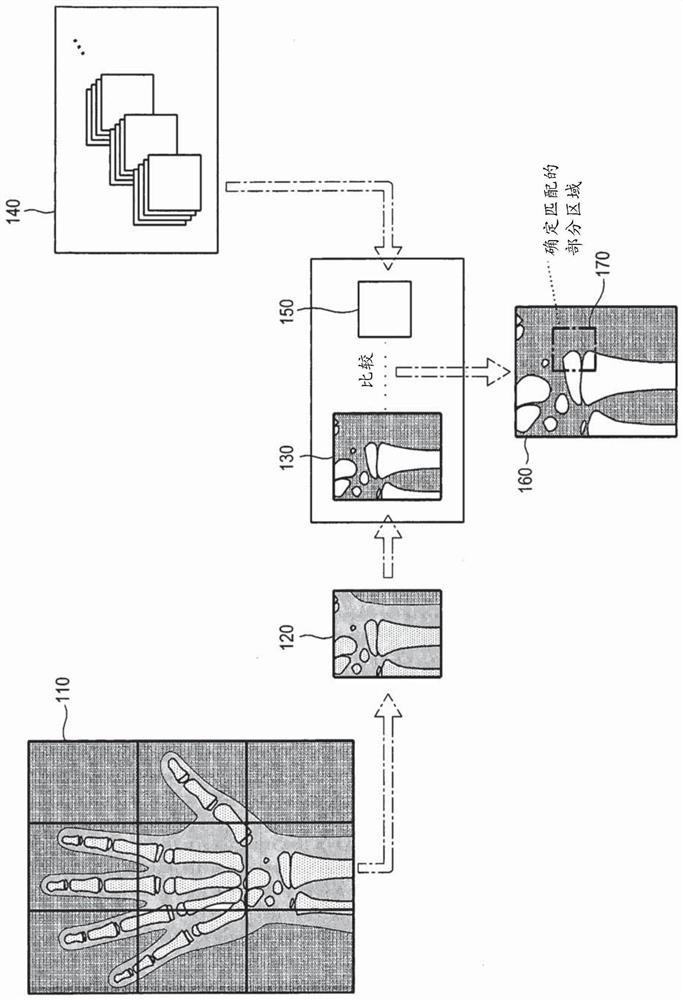 Bone age assessment device, method and recording medium for recording program