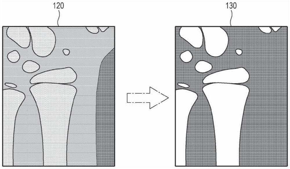 Bone age assessment device, method and recording medium for recording program