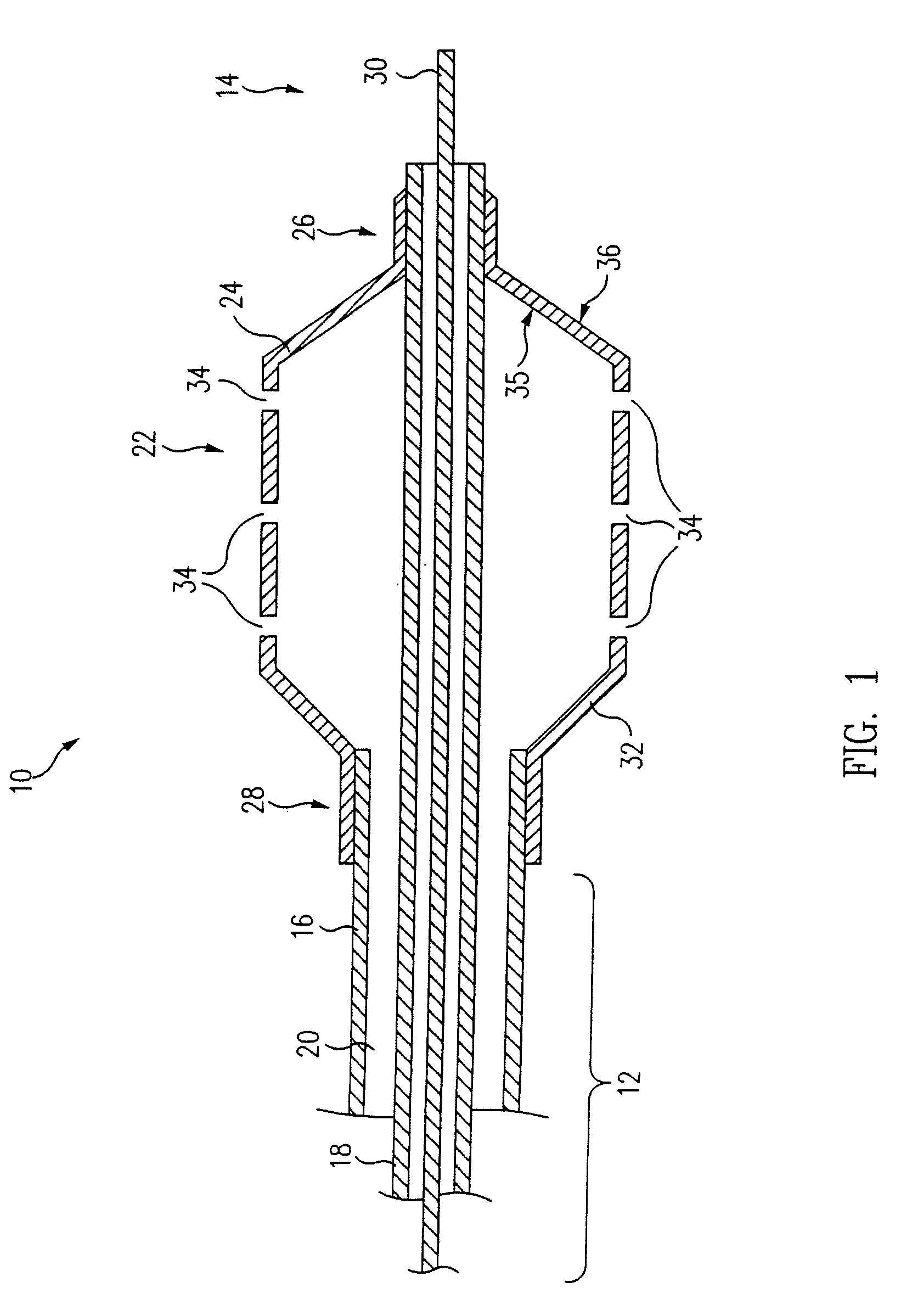 Balloon catheter for delivering therapeutic agents