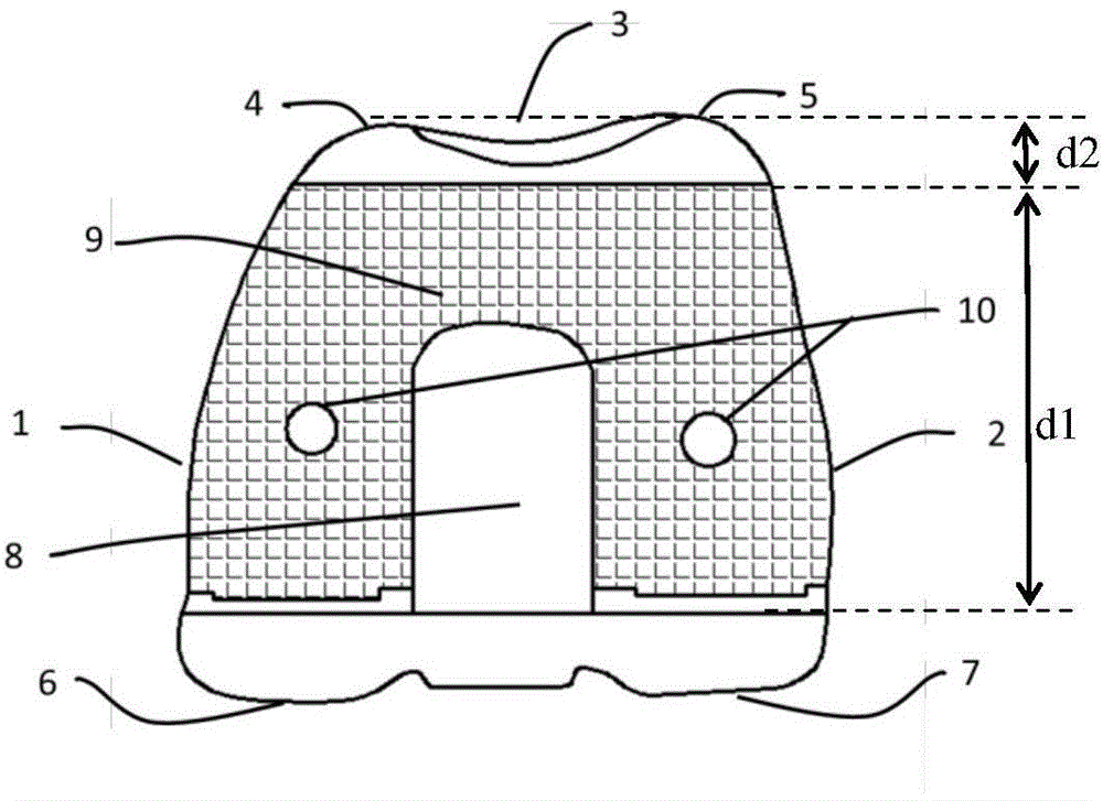 Preartis-matching femoral prosthesis for artificial knee joint