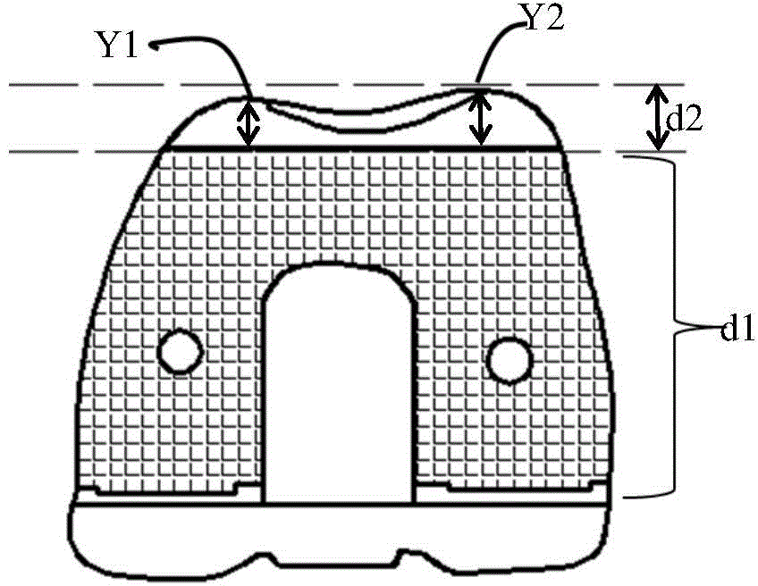 Preartis-matching femoral prosthesis for artificial knee joint