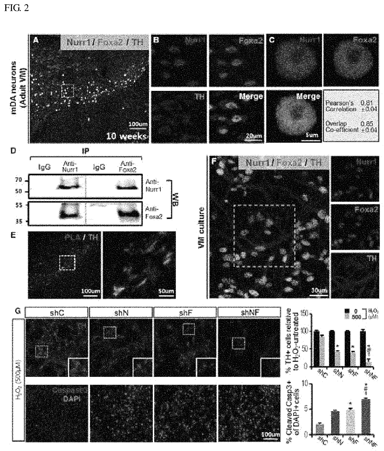 Therapeutic effects of NURR1 and FOXA2 in inflammatory neurologic disorders by M1-to-M2 polarization of glial cells