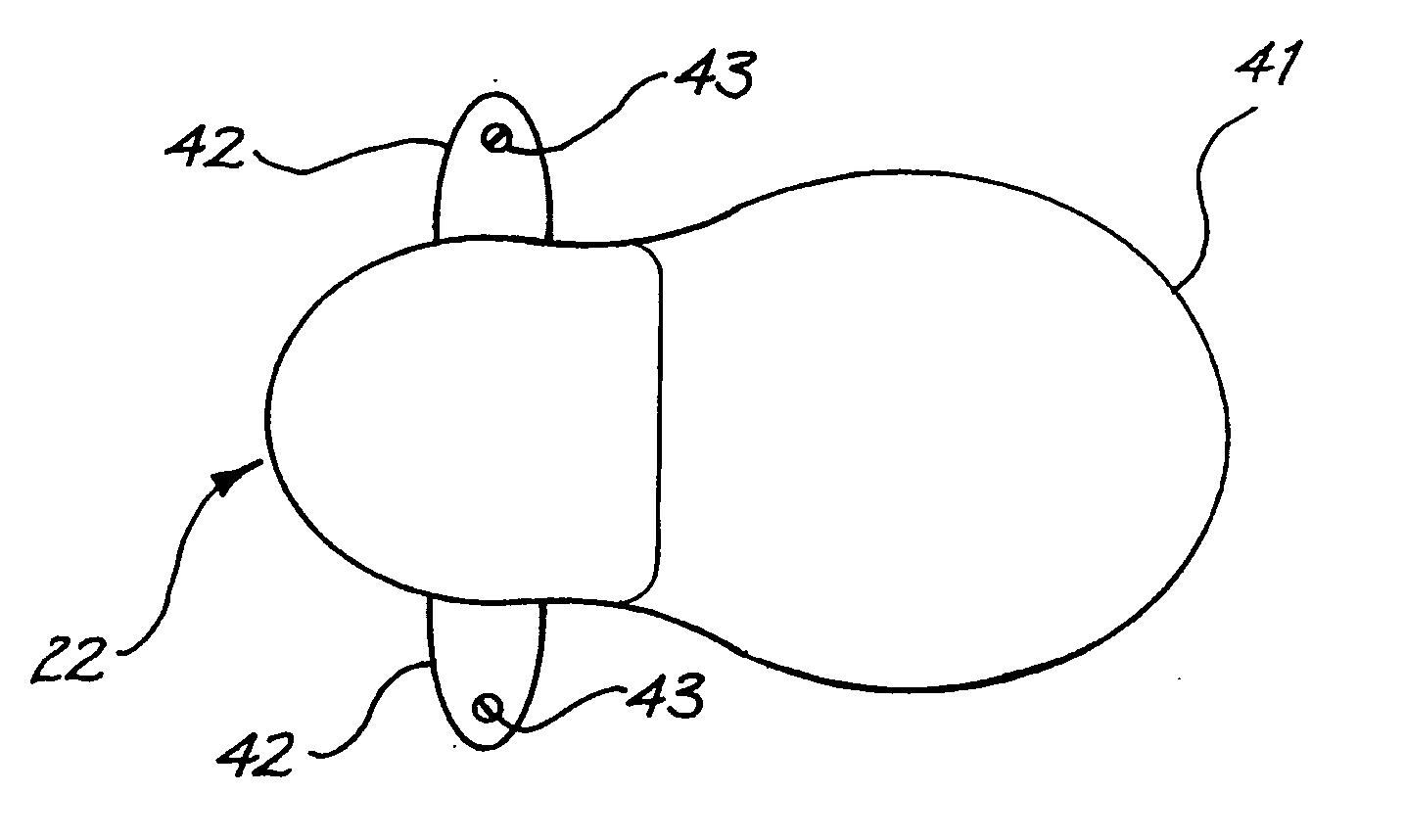 Fixation system for an implantable medical device