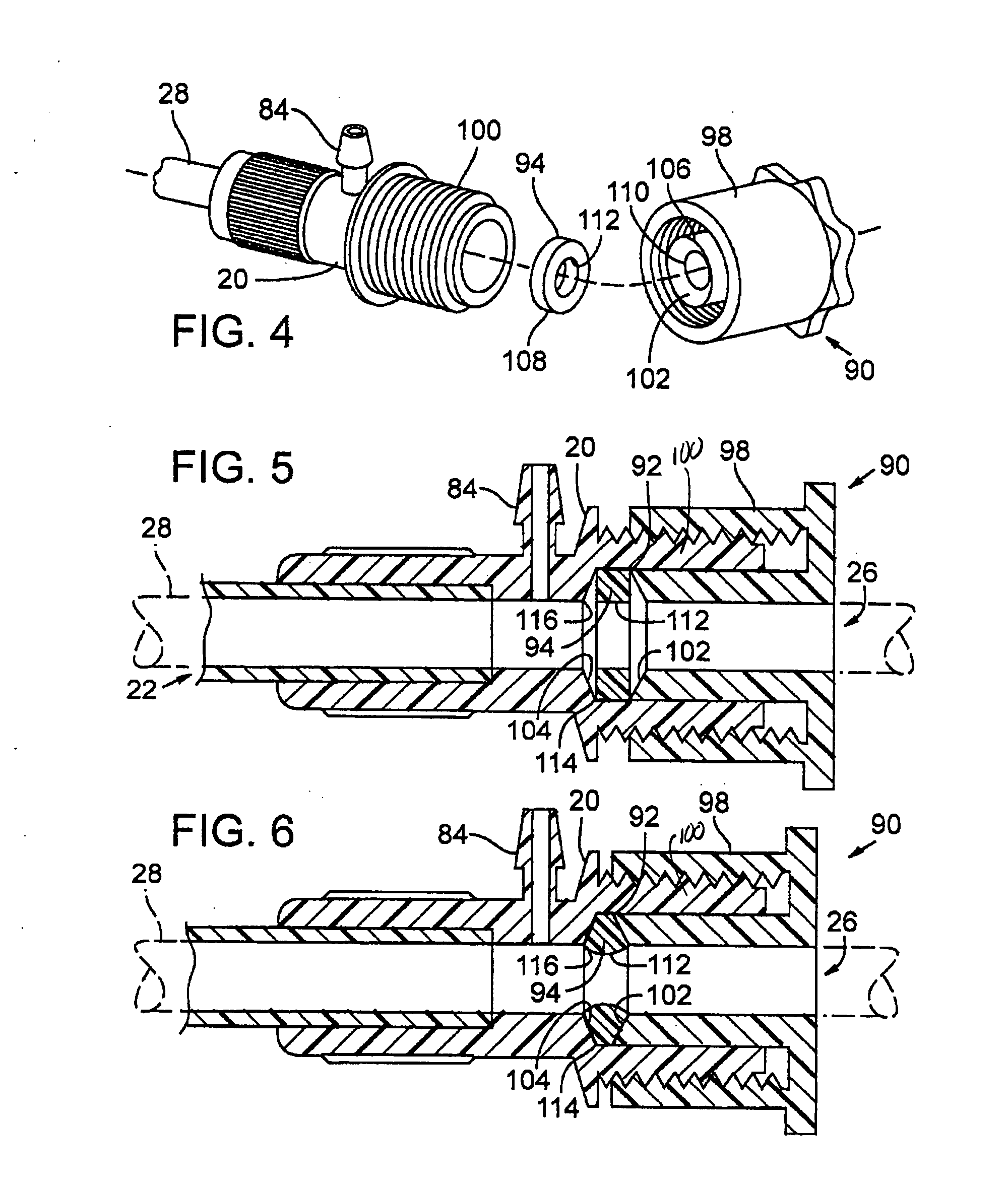 Catheter introducer system