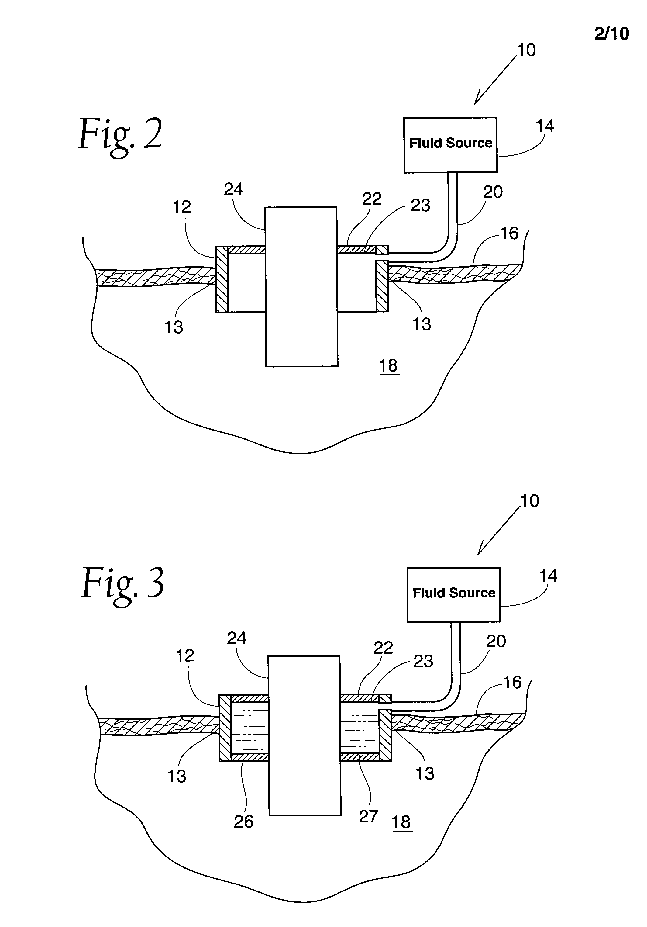 Method and apparatus for preventing air embolisms