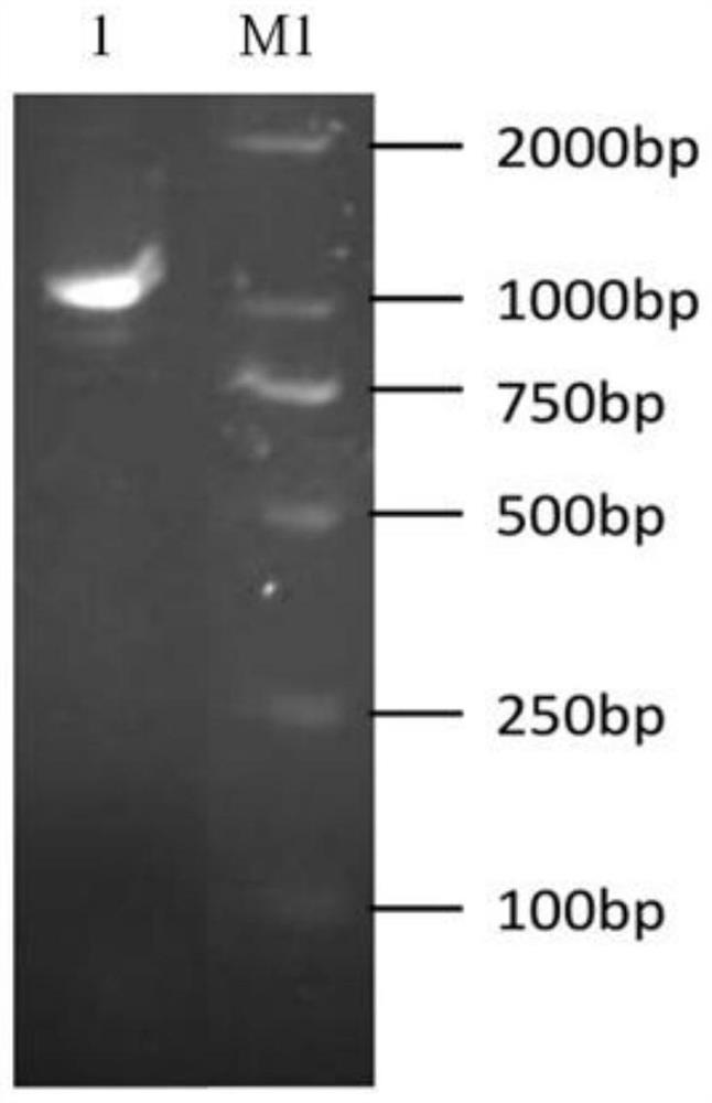 Universal riemerella anatipestifer egg yolk antibody as well as preparation method and application thereof