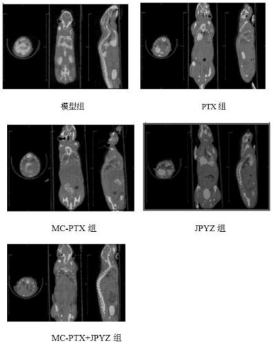 Pharmaceutical composition for improving curative effect of paclitaxel rhythm chemotherapy in treatment of gastric cancer metastasis and preparation method and application thereof