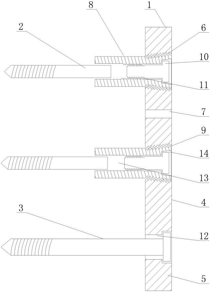 Controllable and slidable locking compression plate for femoral neck