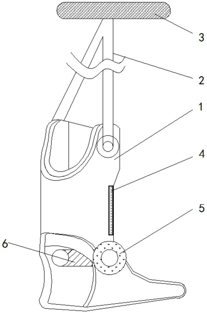 An exercise recovery protective gear for calf fractures