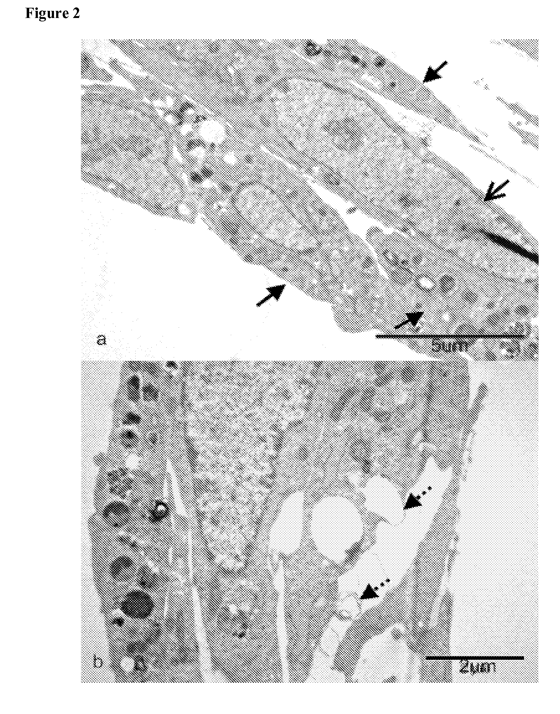 Artificial tissue constructs comprising alveolar cells and methods for using the same