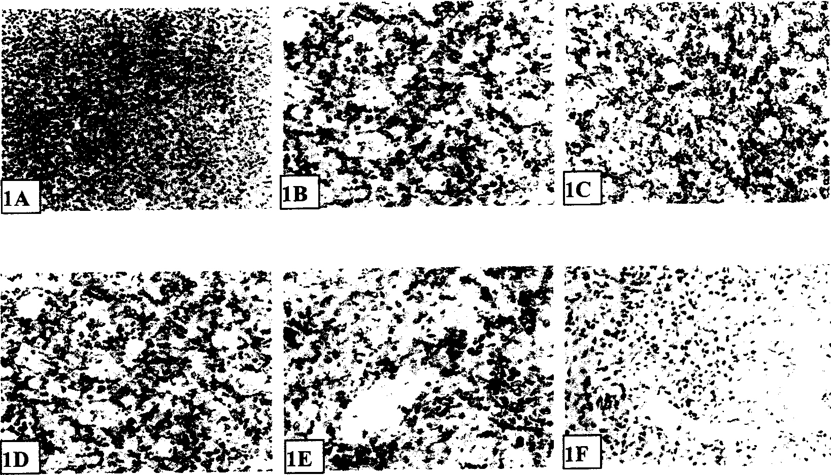 Method for establishing extranodal nasal type NK/T-celllymphoma animal model