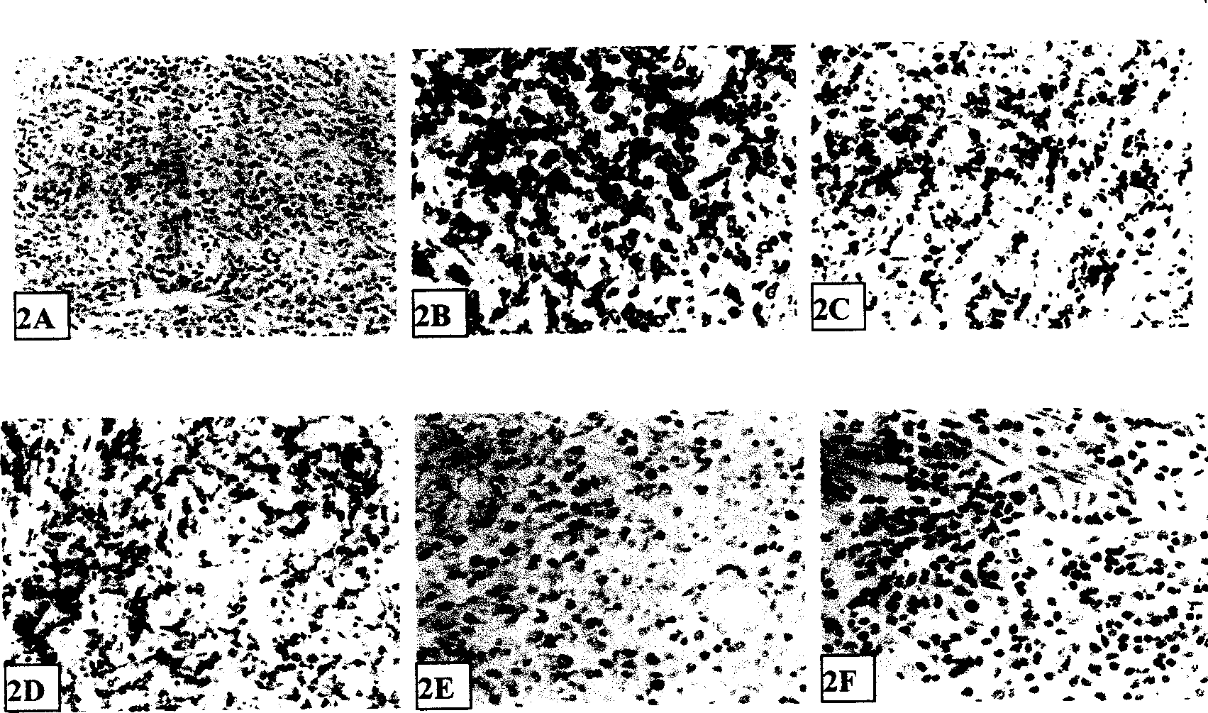 Method for establishing extranodal nasal type NK/T-celllymphoma animal model