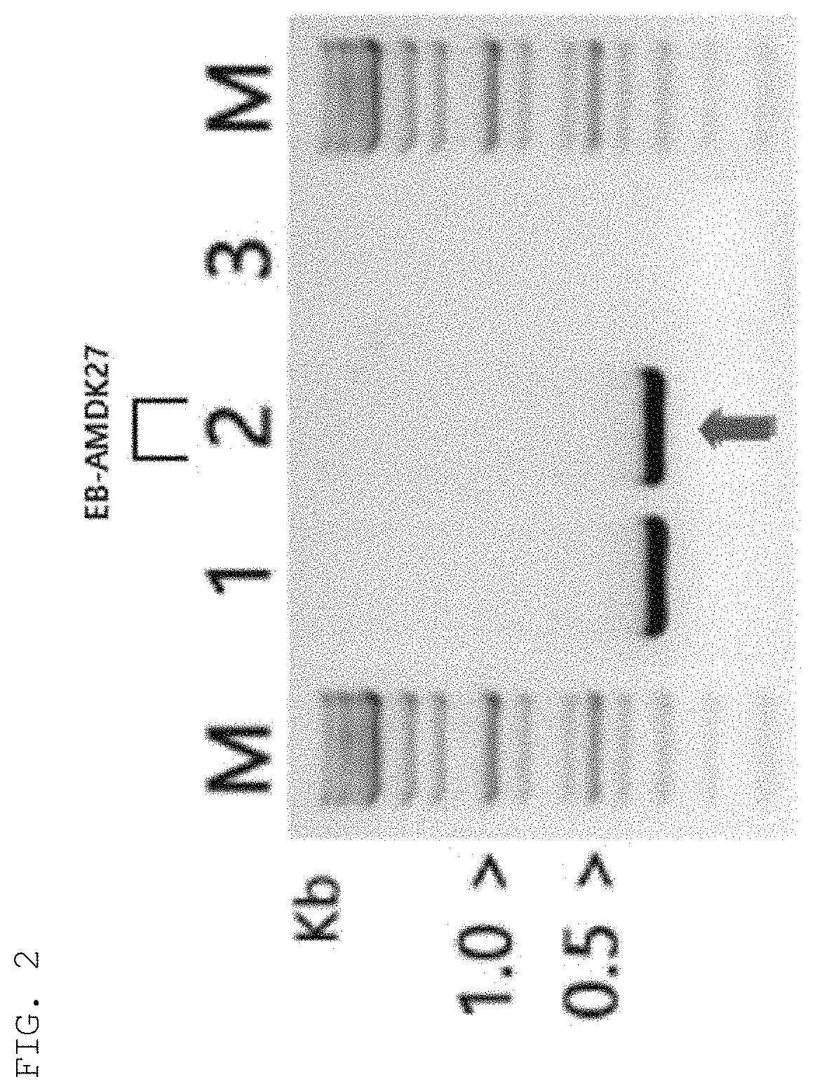 <i>Akkermansia muciniphila </i>EB-AMDK27 strain and use thereof