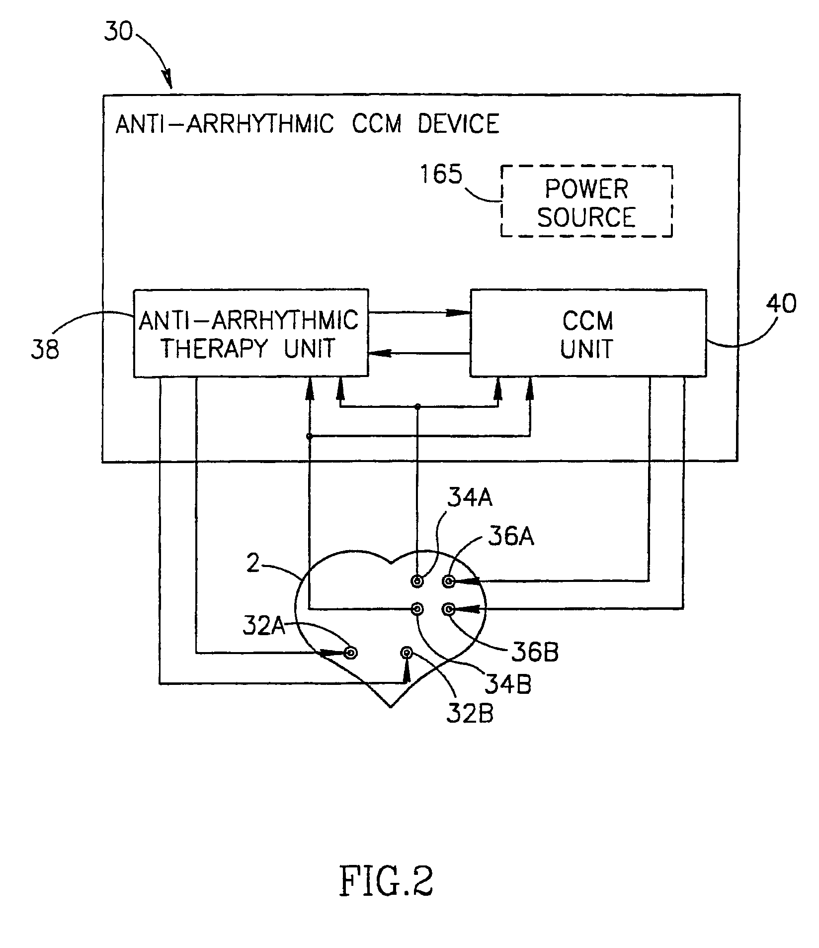 Cardiac contractility modulation device having anti-arrhythmic capabilities and method of operating thereof