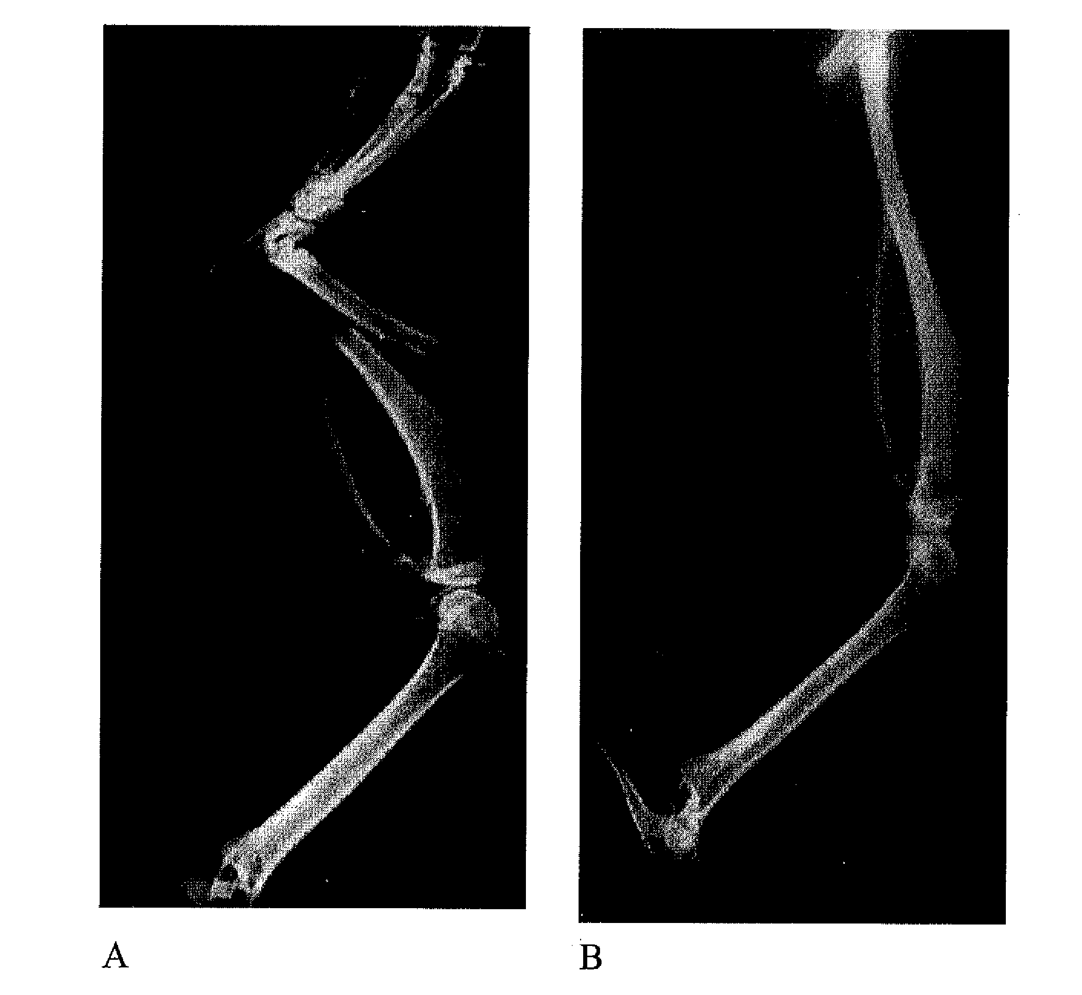 Bone morphogenetic proteins containing a heparin binding site and osteogenic devices and pharmaceutical products containing thereof