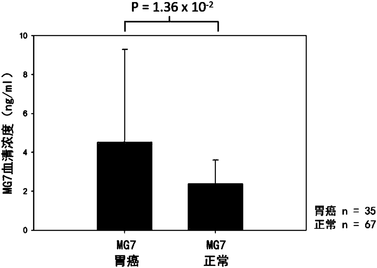 Composition for detecting gastric cancer as well as kit and use thereof