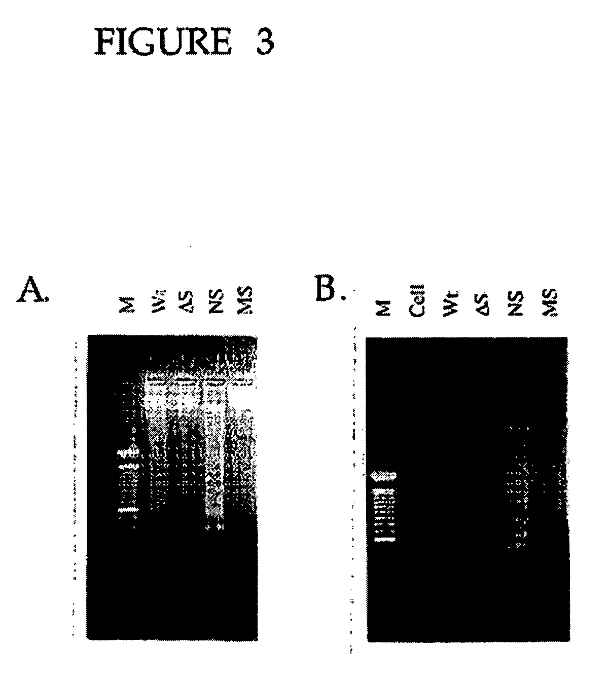 HIV vaccine