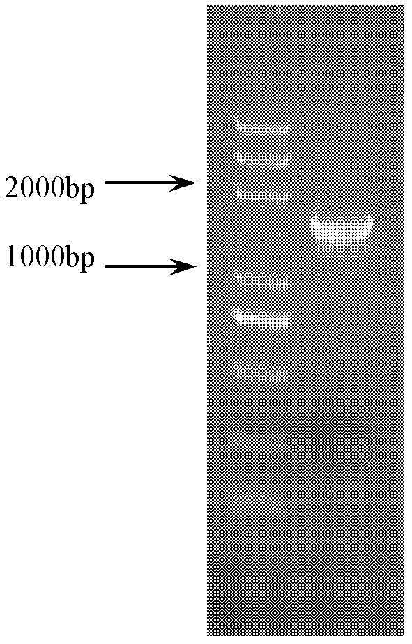 Cholesterol esterase and its nucleotide sequence, recombinant vector, recombinant host cell, preparation method and kit