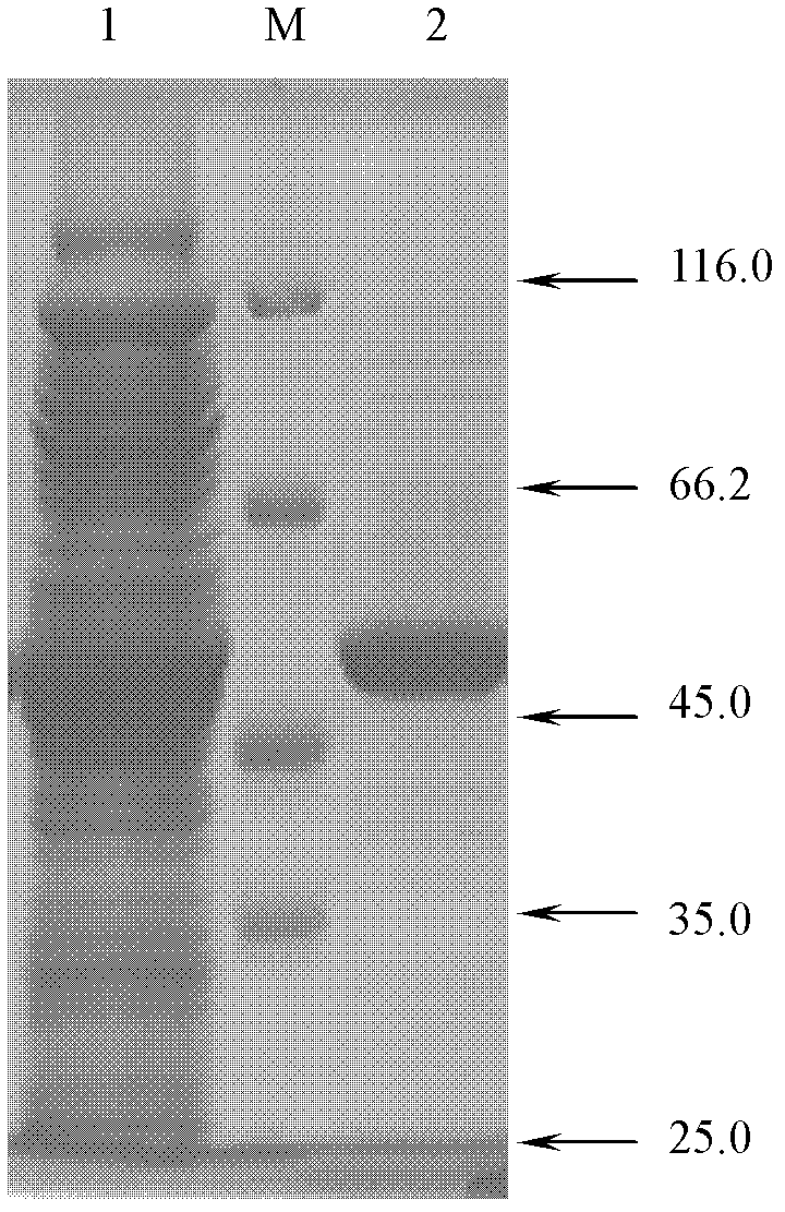 Cholesterol esterase and its nucleotide sequence, recombinant vector, recombinant host cell, preparation method and kit