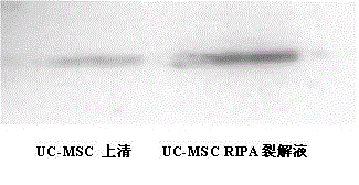 Detection method for biological efficacy of umbilical cord mesenchymal stem cell