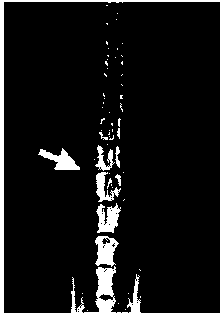 Bone graft material with plasticity and capability of enhancing and accelerating bone formation and preparation method thereof