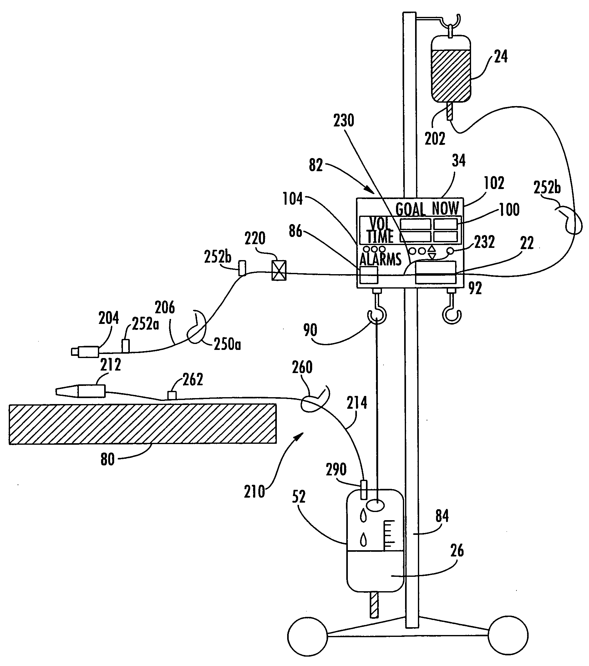 Patient connection system for a balance hydration unit