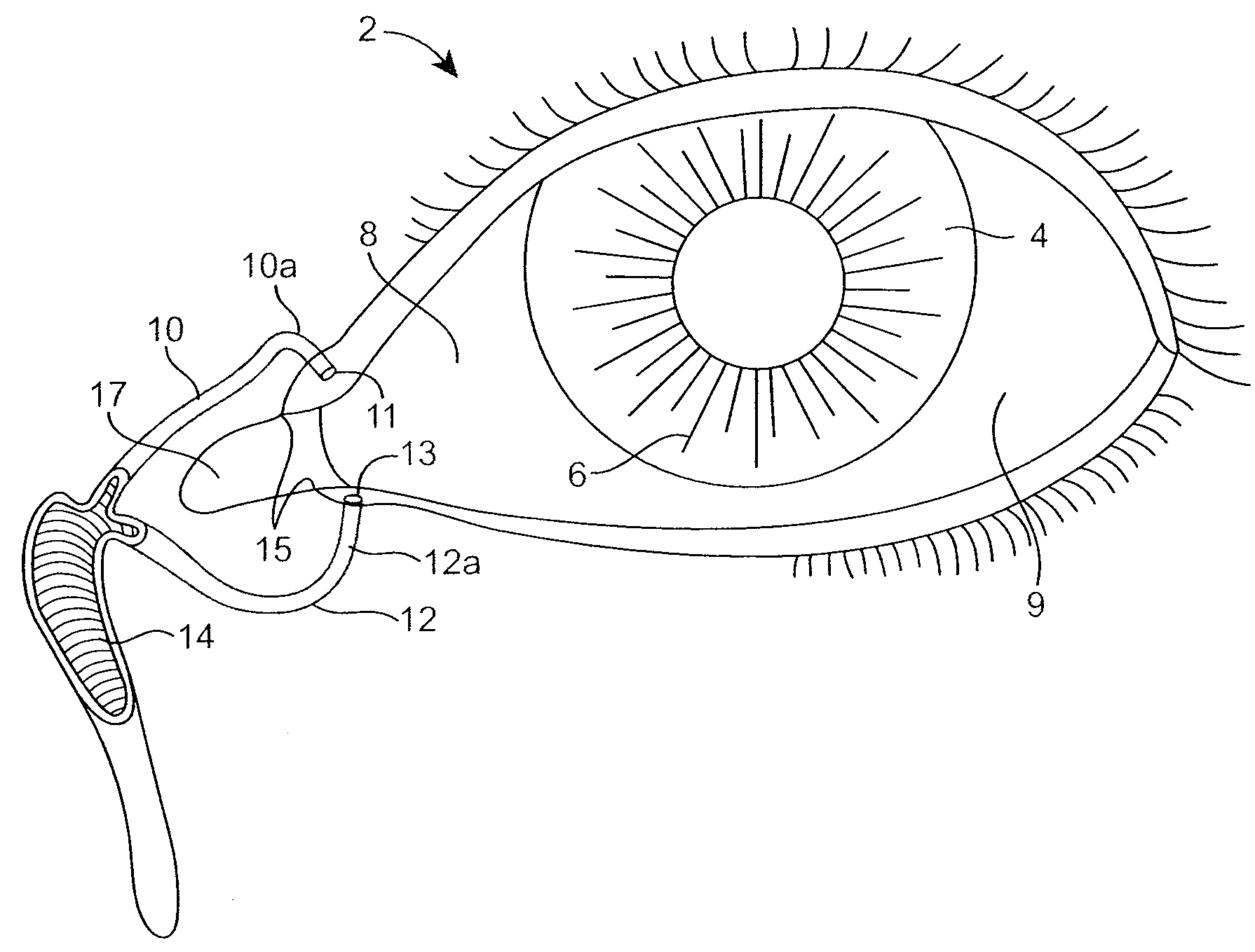 Drug Delivery Methods, Structures, and Compositions for Nasolacrimal System