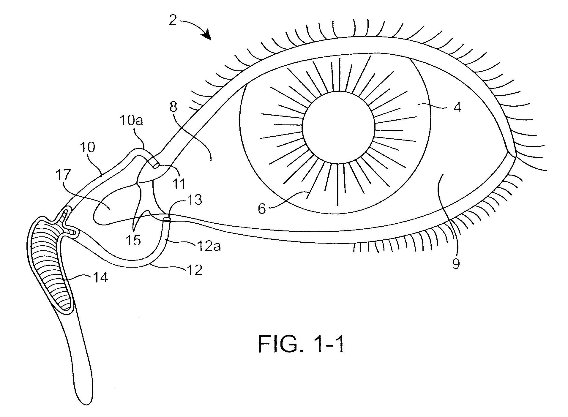 Drug Delivery Methods, Structures, and Compositions for Nasolacrimal System
