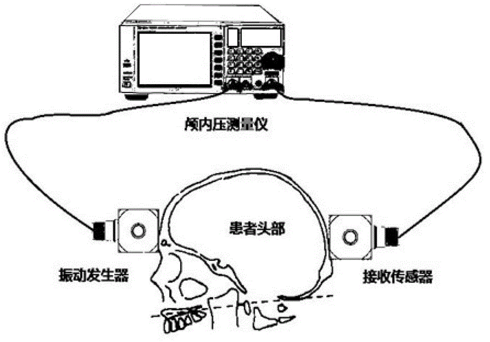 Non-invasive intracranial pressure measurement method and measurement instrument