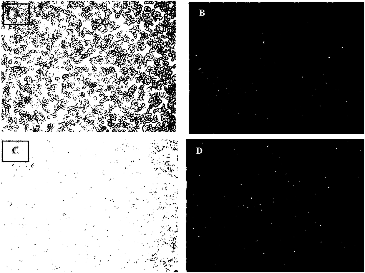 Rabies virus labeling whole brain area neural network structure, and preparation and application thereof