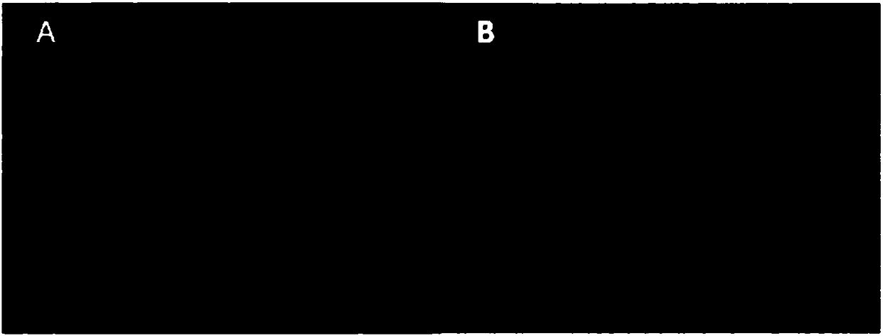 Rabies virus labeling whole brain area neural network structure, and preparation and application thereof