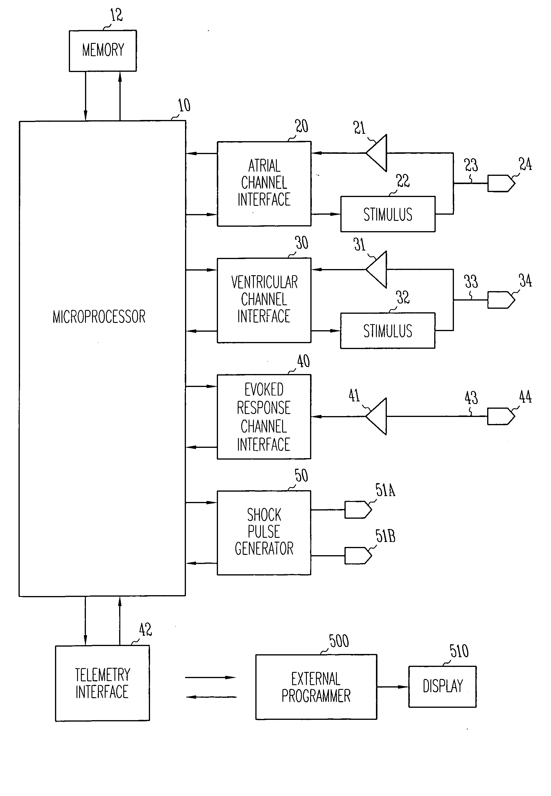 Method and system for automatic anti-tachycardia pacing