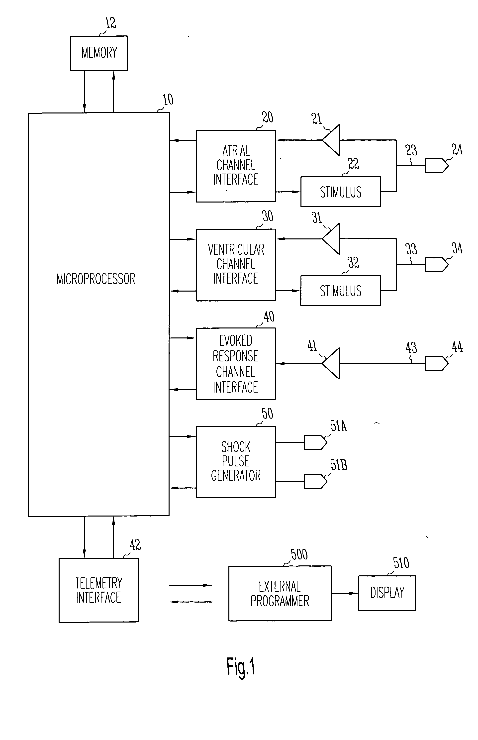 Method and system for automatic anti-tachycardia pacing