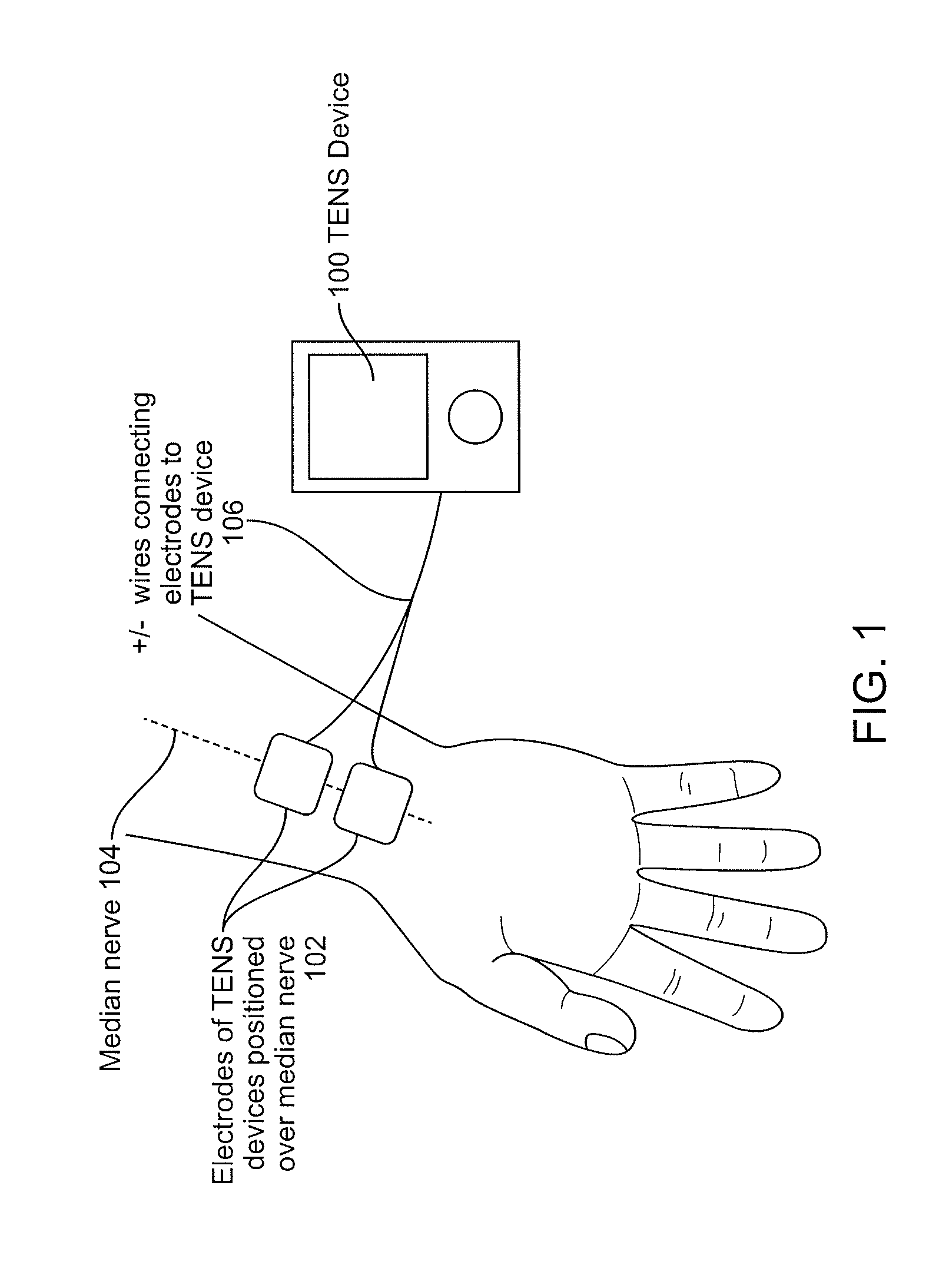 Devices and methods for controlling tremor