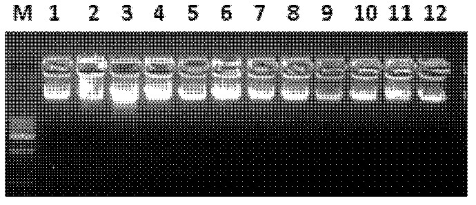 Fluorescent automated detection primer and kit of pathogenic sites of Arachnomelia syndrome (AS) in Simmental cattle