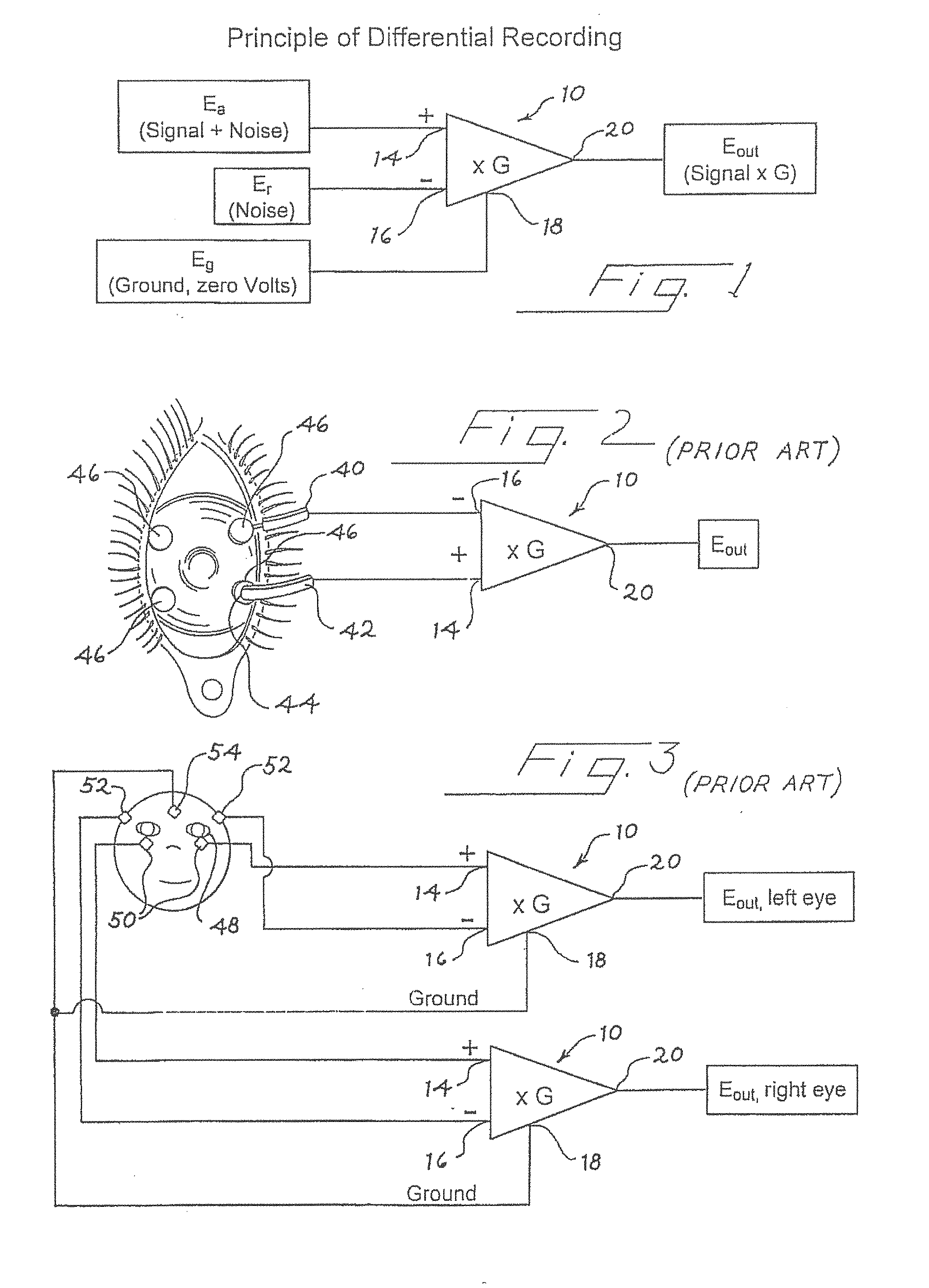 Apparatus and methods for mapping retinal function