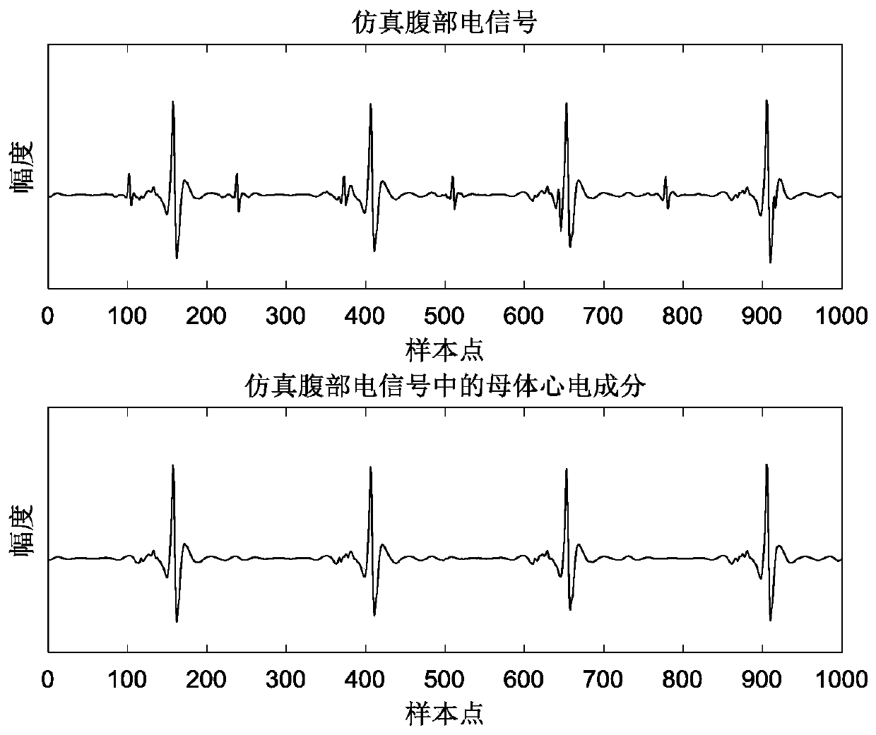 Fetal electrocardiogram extraction system based on convolutional encoding-decoding neural network and method