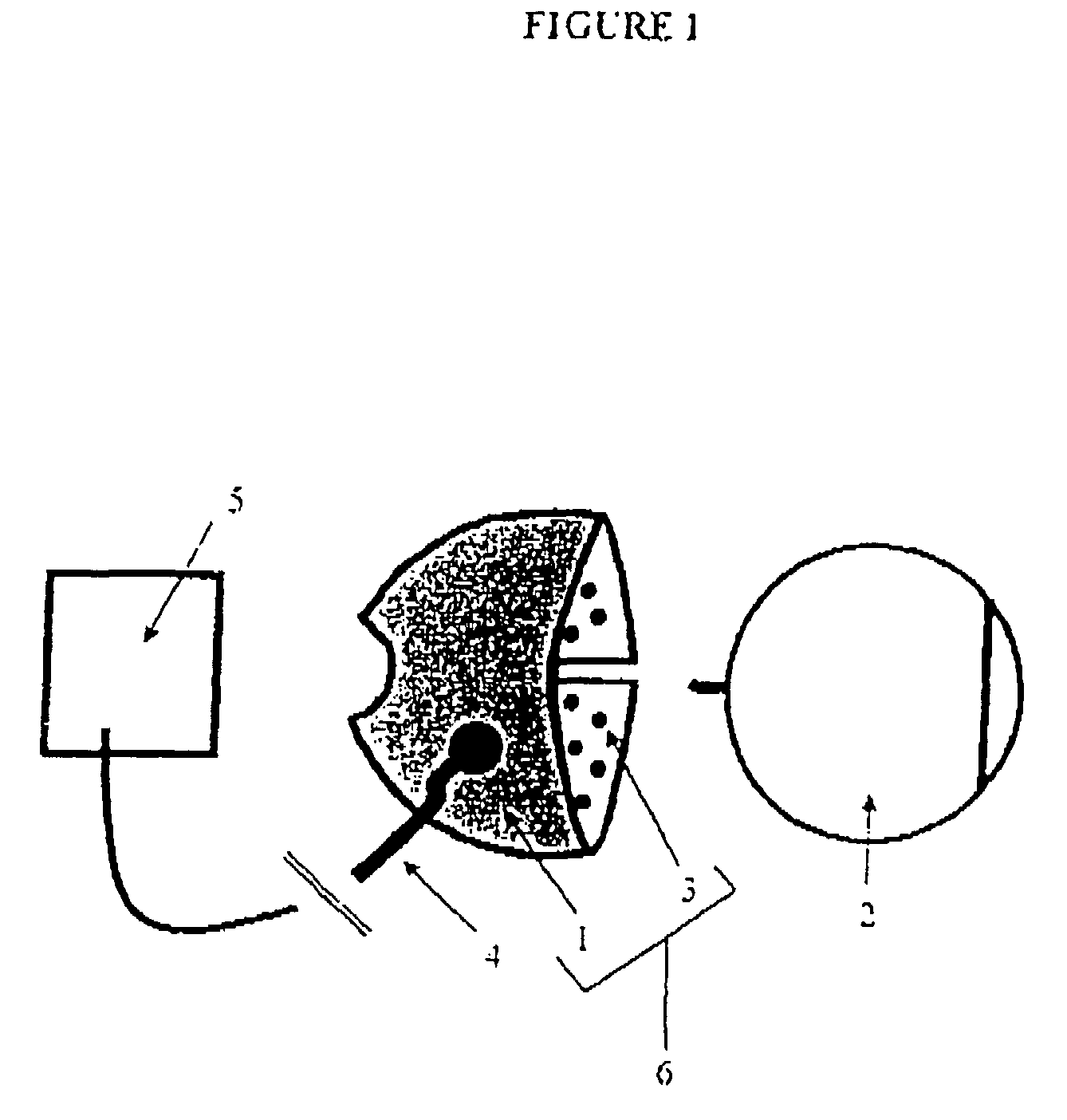 Extraocular device