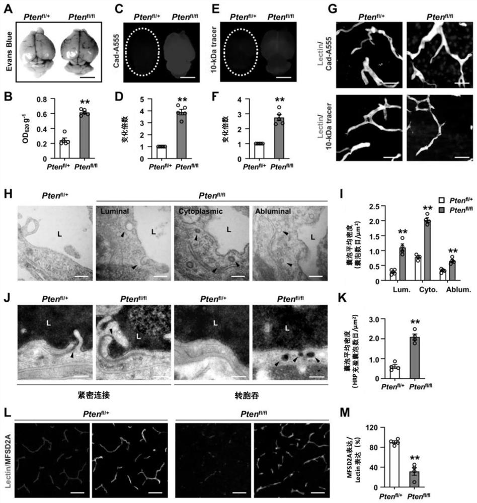 Method for regulating and controlling blood brain barrier permeability and application of method for regulating and controlling blood brain barrier permeability