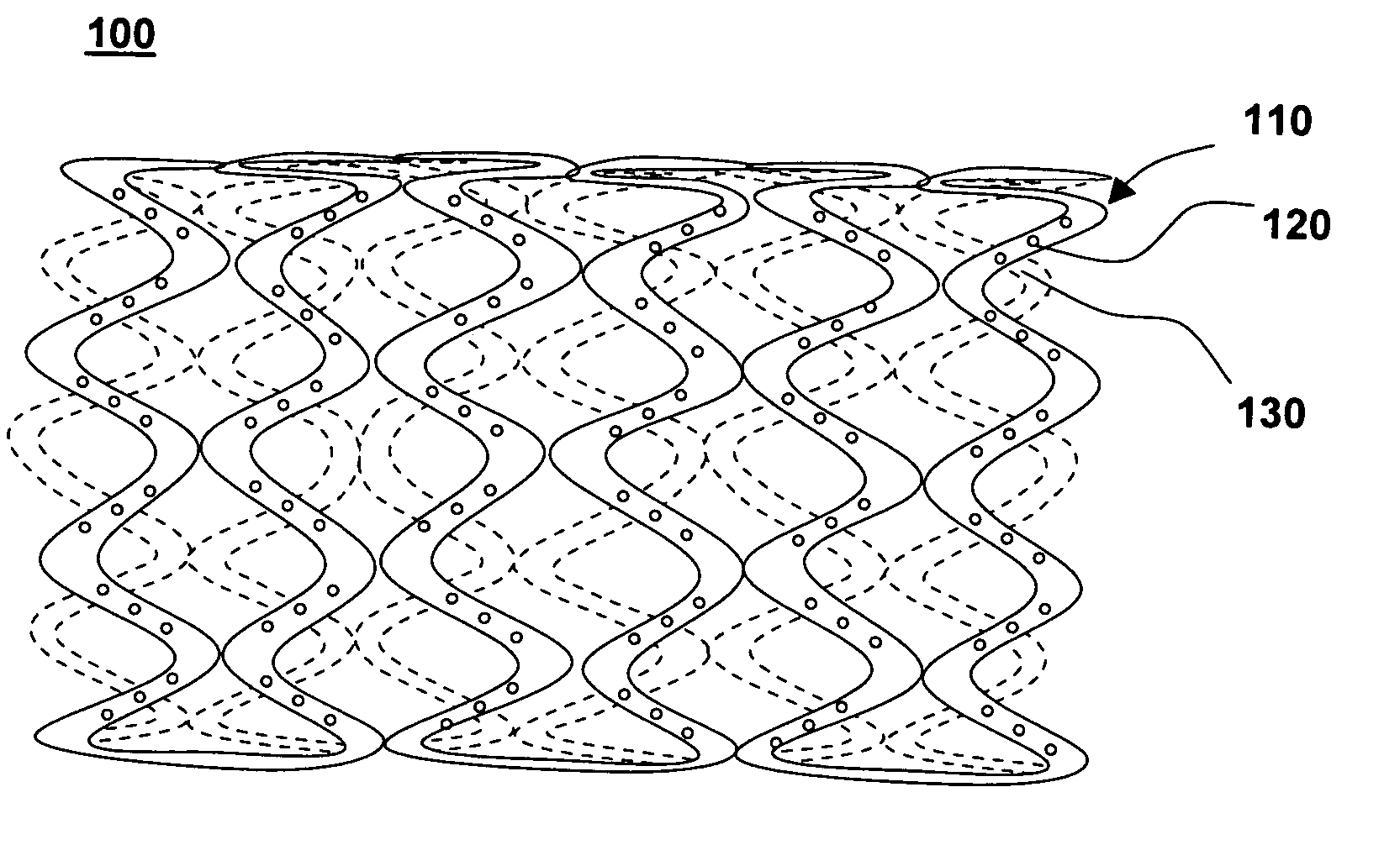 Drug-eluting stent for controlled drug delivery