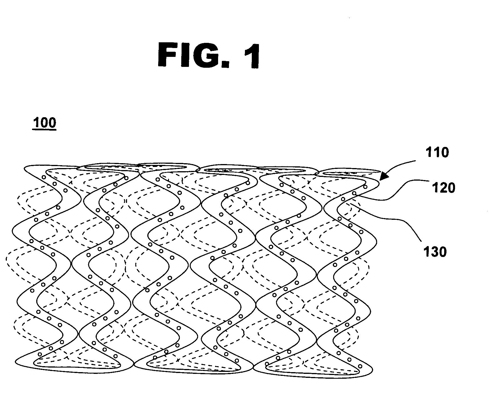 Drug-eluting stent for controlled drug delivery