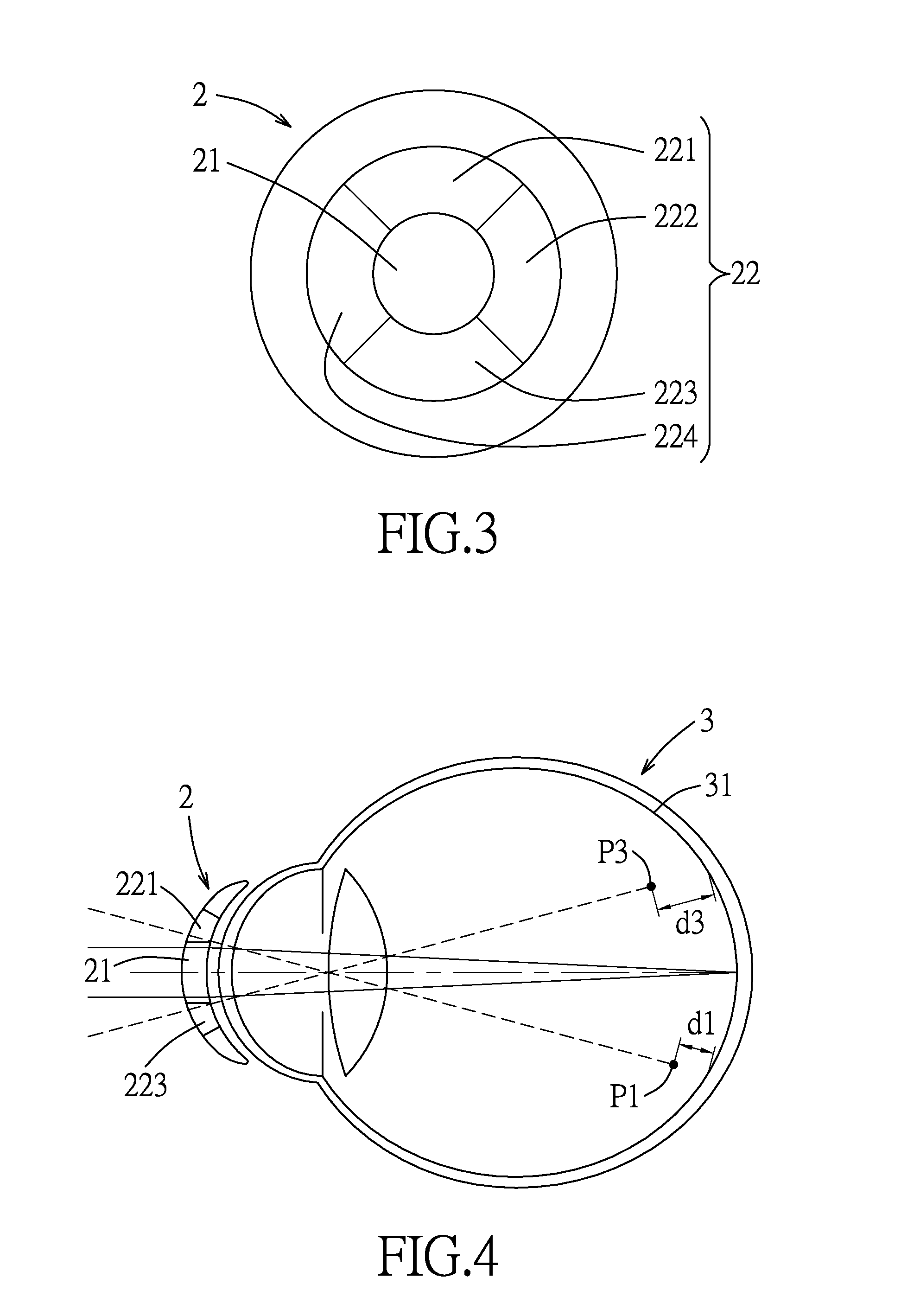 Lens and method for correcting vision of a user