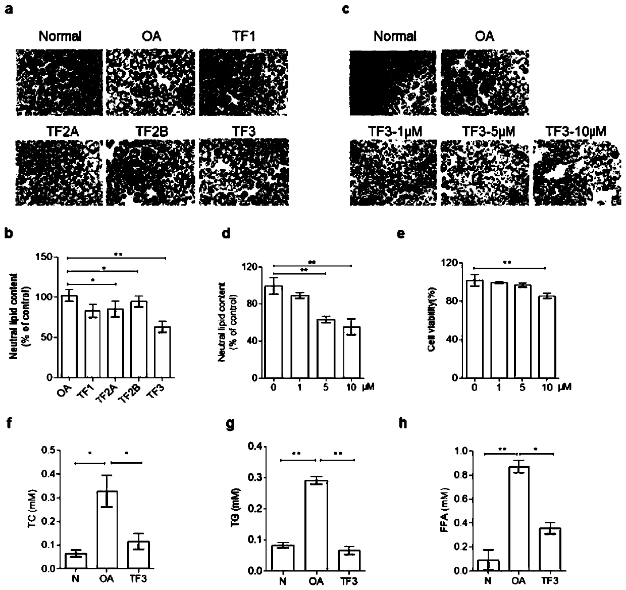 Application of theaflavin TF3 to preparation of PK (plasma kallikrein) inhibitor and medicines for NAFLD (non-alcoholic fatty liver disease) treatment