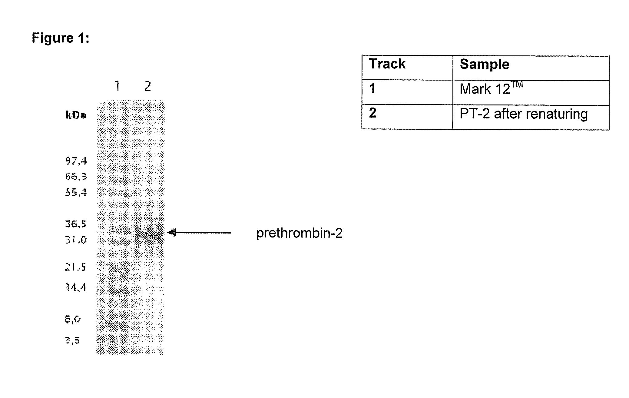 Method for producing recombinant thrombin