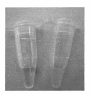 Method for quickly detecting gonorrhea Neisseria by utilizing loop-mediated isothermal amplification technology