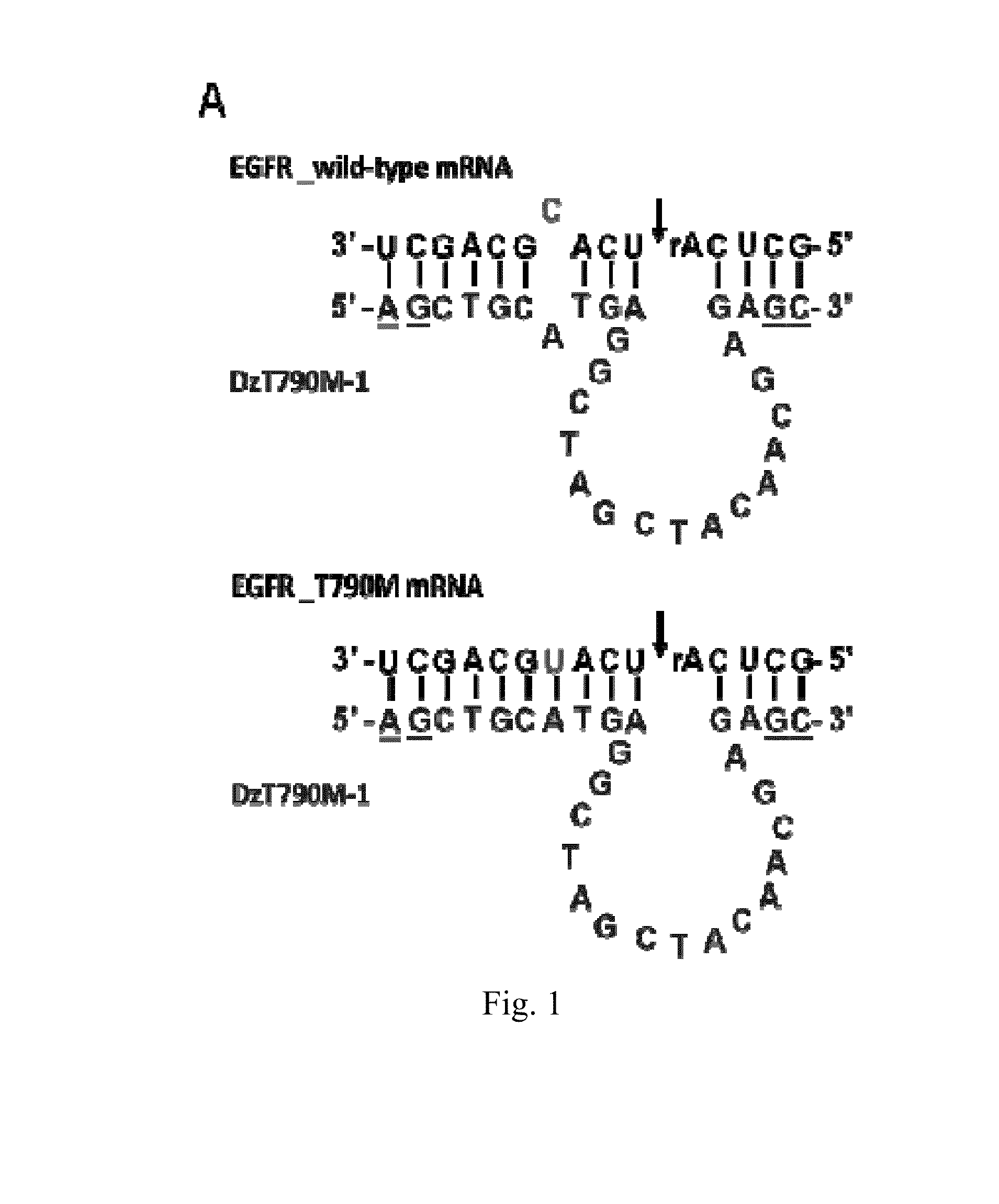 Dnazyme for silencing the expression of EGFR