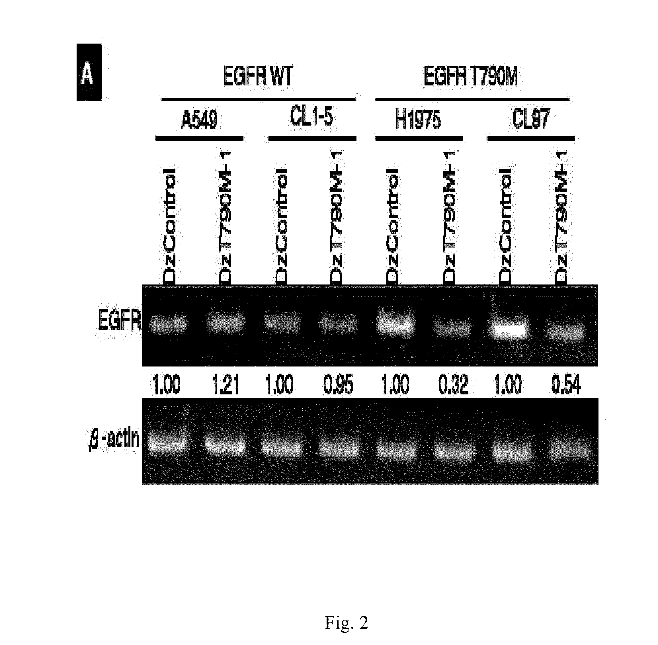 Dnazyme for silencing the expression of EGFR